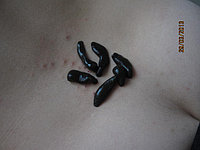 Пиявки для лечения, пиявки оптом