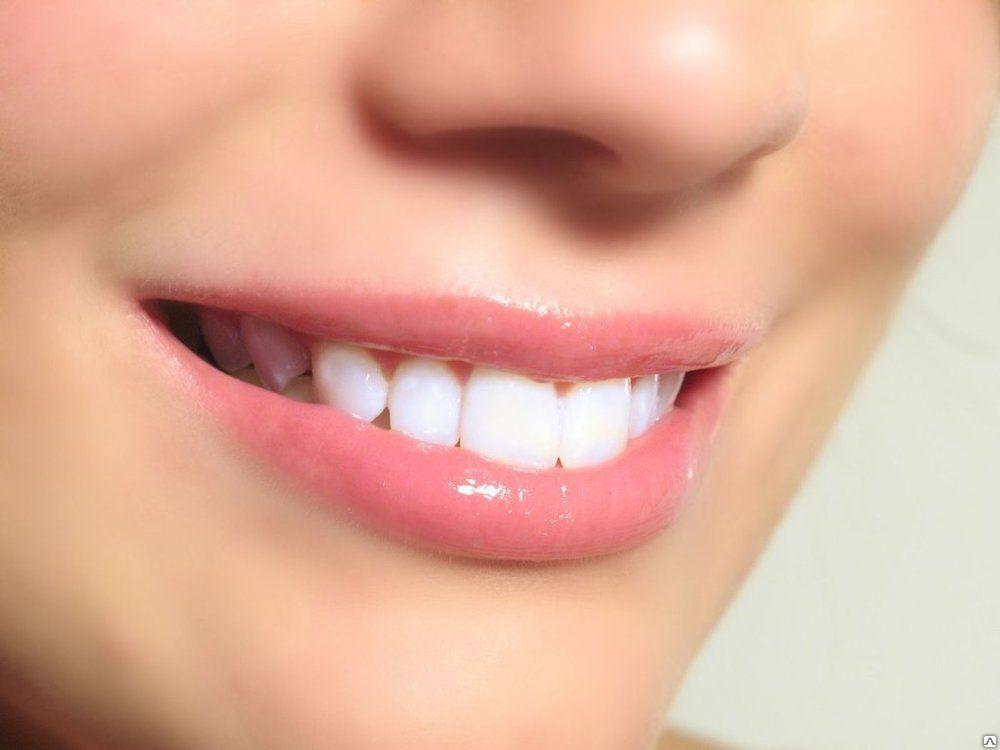 Отбеливание зубов - фото 1 - id-p5701962