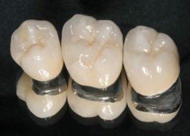 Protetica dentara - фото 1 - id-p39102