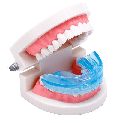 Капа G-Tooth Trainer для выпрямления зубов - фото 1 - id-p9559753
