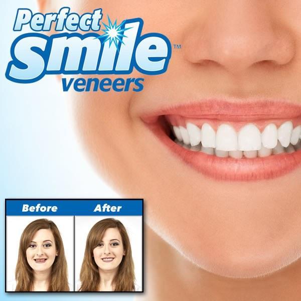 Perfect Smile Veneers за 490 руб - фото 1 - id-p10514831