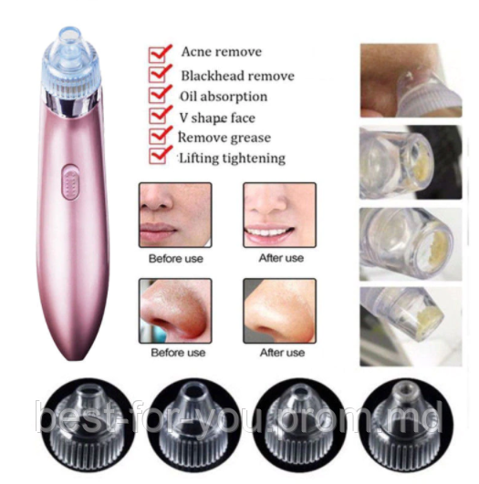 Косметологический прибор для очищения кожи Vacuum pore Cleaner - фото 1 - id-p5759295